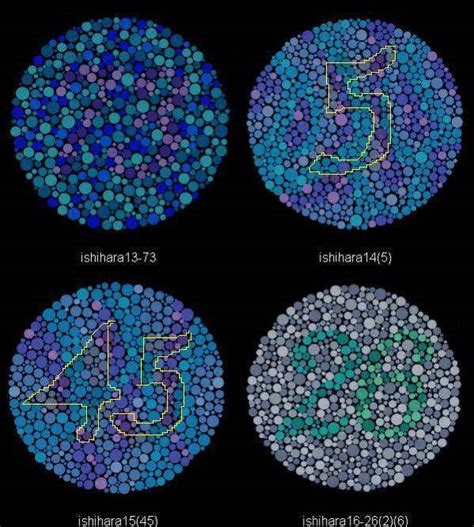 how hard is the latern test with mild protan|protan color blindness test results.